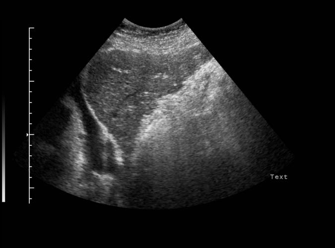 3a av  Catherine Olsson, sonograf